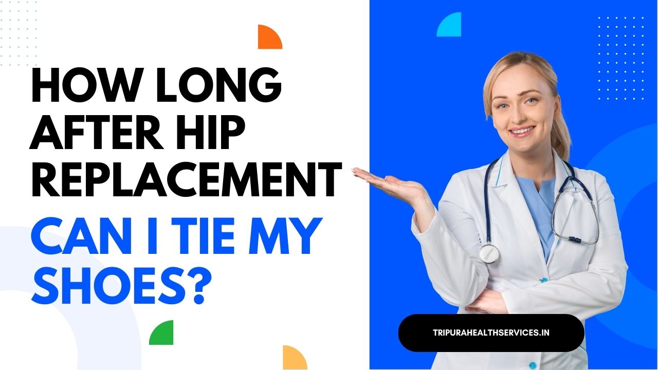 How Long After Hip Replacement Can I Tie My Shoes? : Detailed Guide 2023