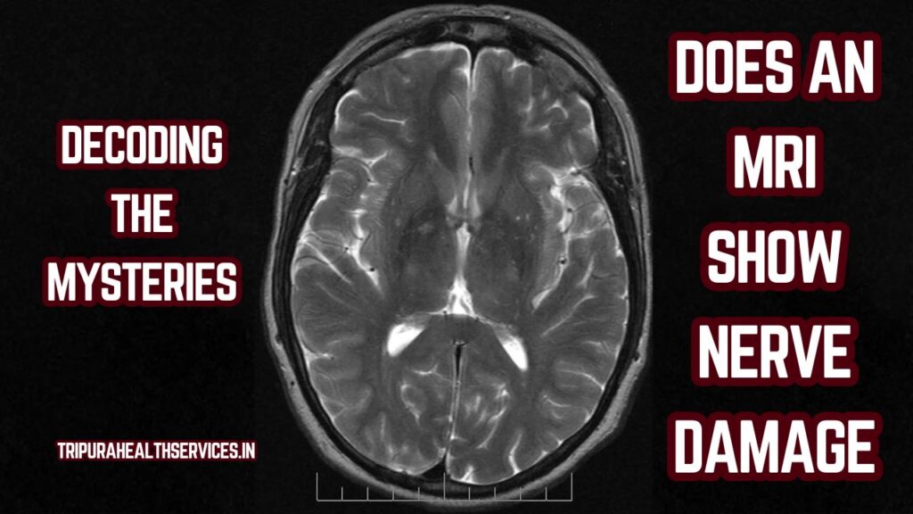 Does an MRI Show Nerve Damage