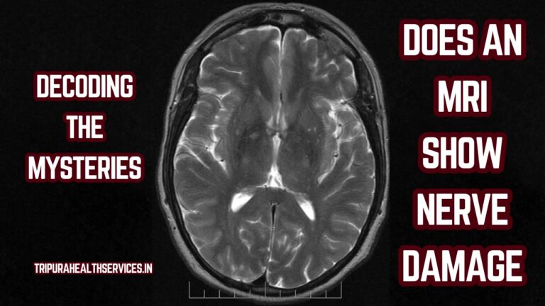 decoding-the-mysteries-does-an-mri-show-nerve-damage-wealth-wise