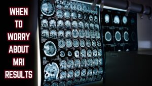 When to Worry About MRI Results